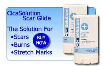Scar reducing treatments by CicaSolution